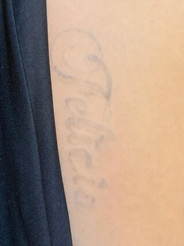 Tatoeage na 3 laserbehandelingen bij By Shay